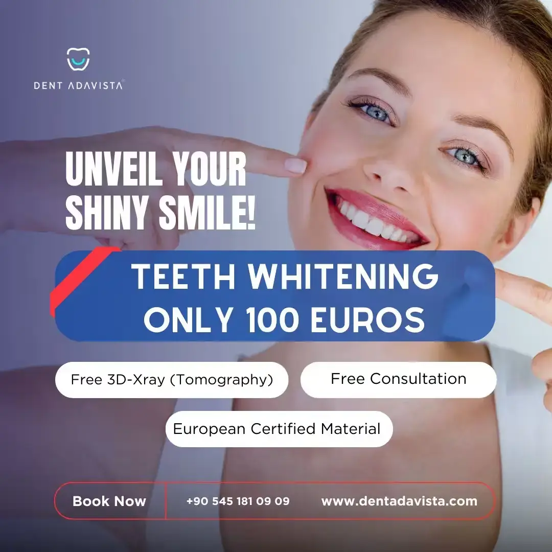 Teeth whitening